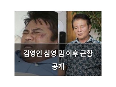 김영인 심영 밈 이후 근황 공개